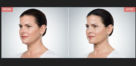 Natural Ways to Reduce Chin Fat Without Surgery - Hunter Games Magazine