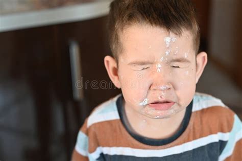 Adorable Little Boy With With Rashes On His Face Sneezing Portrait Of