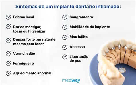 Dor No Dente Ao Lado Do Implante