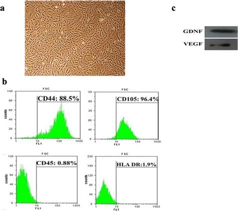 Culture Expansion And In Vitro Characterization Of Ucmsc A