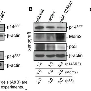 A Western Blot Analysis Of Expression Levels Of P14ARF In LNCaP Top