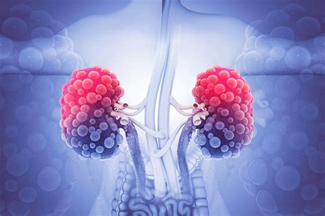 Diabetic complication - nephropathy (National Diabetes Month) | Dr ...