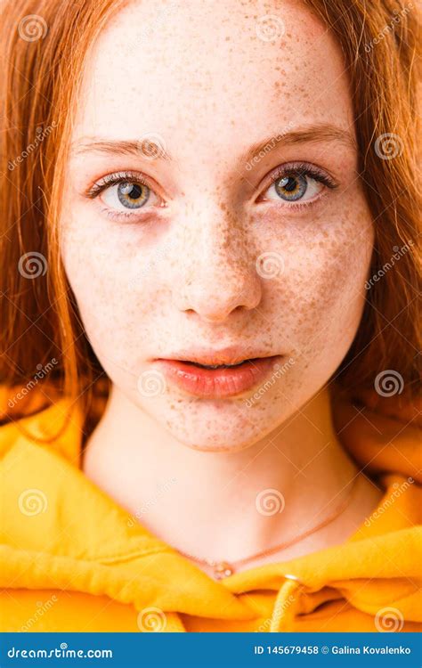 Portrait Of An Emotional Red Haired Girl With Freckles And Braces On A