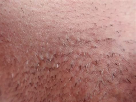 Close Up Penis Nude Pics XHamster