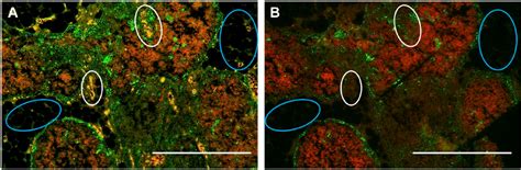 Optimization Of Single And Dual Color Immunofluorescence Protocols For