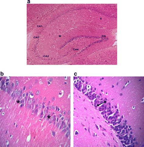 Representative photomicrographs of H& E stained brain sections from all ...