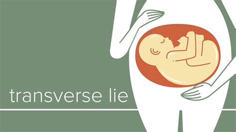 Baby Positions In Womb What They Mean