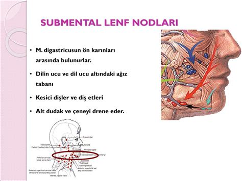 Lenf Nodu Muayenes Ve Lenfadenopat Ler Ppt Indir