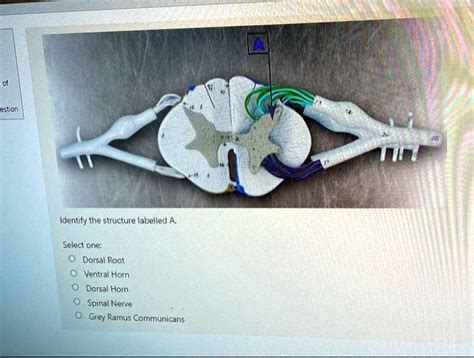 Solved Question Identify The Structure Labelled A Select One