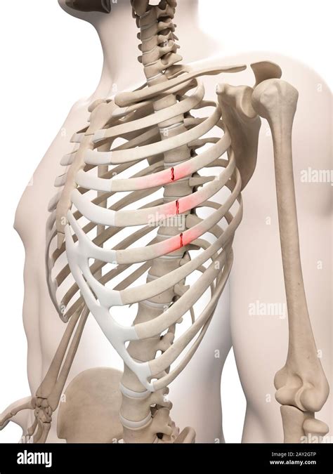 C Tes Fractur Es Banque De Photographies Et Dimages Haute R Solution