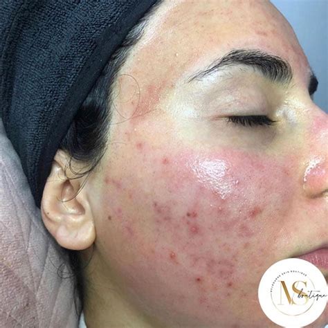 Home Melbourne Skin Boutique