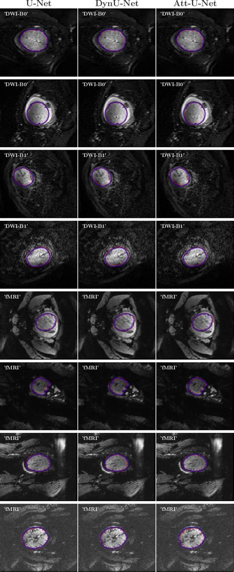 Figure From Fetal Bet Brain Extraction Tool For Fetal Mri Semantic