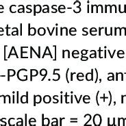 , ANA positive control and serum from ANA positive patients with SLE ...