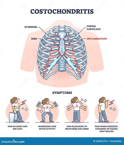 Costochondritis Cartoons, Illustrations & Vector Stock Images - 10