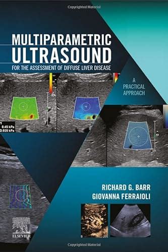 Multiparametric Ultrasound For The Assessment Of Diffuse Liver Disease