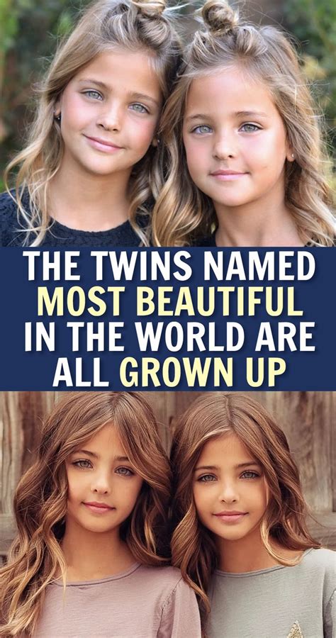 The Twins Named Most Beautiful In The World Are All Grown Up Twin Names Twins Mother