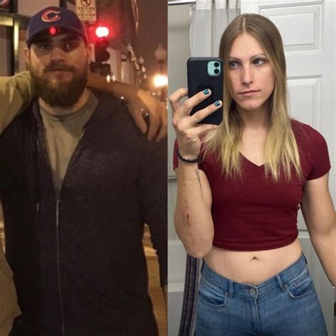 New People 22 Photos Of Transgender People Before And After Sex Change Pictolic