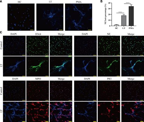 Frontiers Neutrophil Extracellular Traps Regulate Hmgb1 Translocation