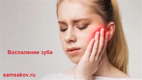 Воспаление зуба: симптомы, облегчение и когда обратиться к стоматологу ...