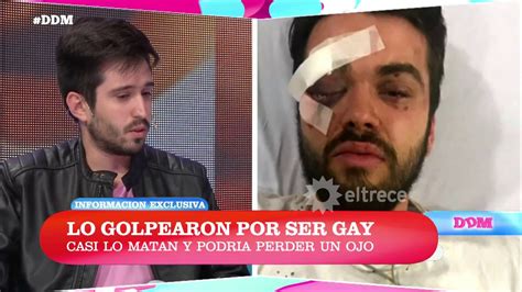 Un Joven Fue Atacado Por Ser Gay Habla El Amigo Que Presenci El Hecho Youtube