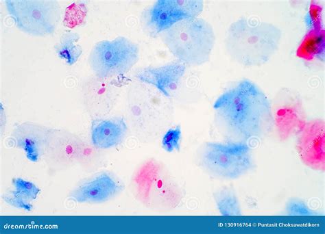 Squamous Epithelial Cells Under Microscope