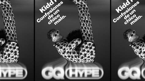 Kidd Keo Yo Entendí De Muy Pequeño Que Si Quería Vivir De Lo Que Me
