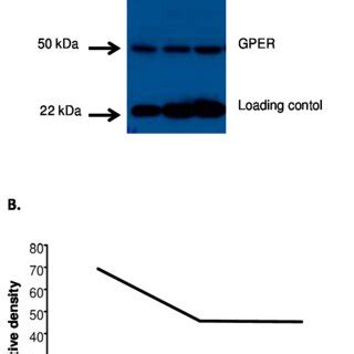 The Protein Expression Of Gper Was Demonstrated By Using Western