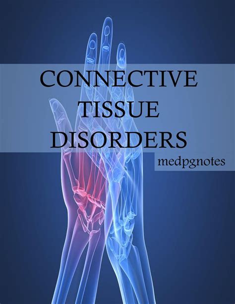Connective Tissue Disorders Sample