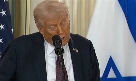 Miss Ppk Candidata Do Rio Vence Concurso Da Vagina Mais Bonita Do Brasil