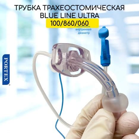 Что такое трахеостома: её виды и особенности