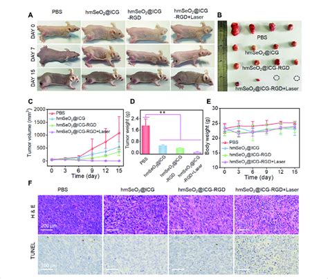 A Representative Photographs Of Breast Carcinoma Bearing BALB C Nude