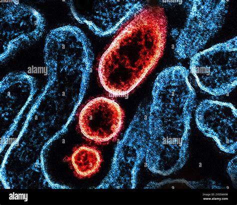 Colorized Transmission Electron Micrograph Of Mature Extracellular