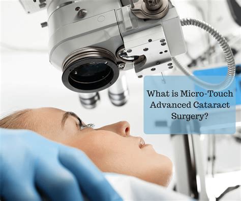 What Is Micro Touch Advanced Cataract Surgery Wiles Eye Center