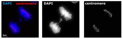 Unraveling the Versatility of Anti-Centromere Antibodies in Diagnostic