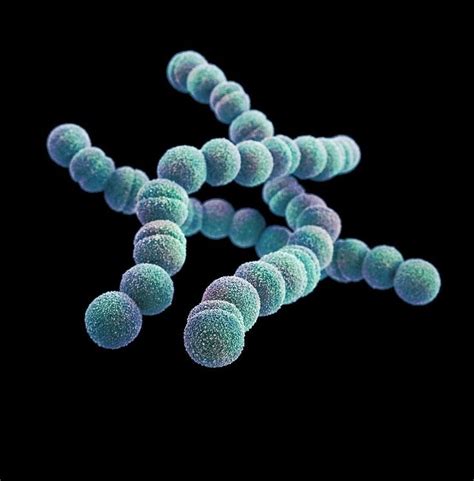 Fiebre Reum Tica Streptococcus Pyogenes O Estreptococo Beta Hemol Tico