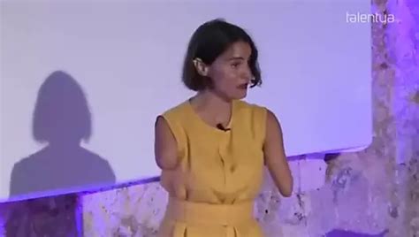 Free Triple Amputee Porn Videos XHamster