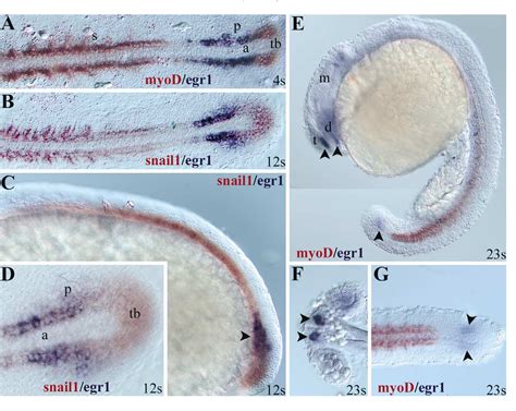 Figure From Expression Of The Zinc Finger Egr Gene During Zebrafish