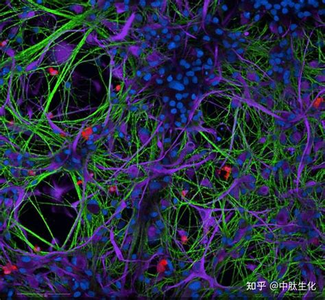 Nature子刊：新型铁死亡调节因子，诱导小胶质细胞死亡，进而诱发神经退行性疾病 知乎