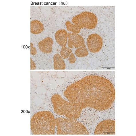 Solarbio K111930P Anti CDKN2C Polyclonal Antibody 试剂仪器耗材