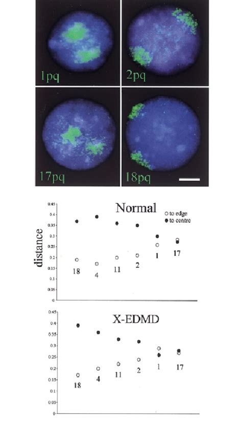 The position of selected chromosome territories in both normal and ...