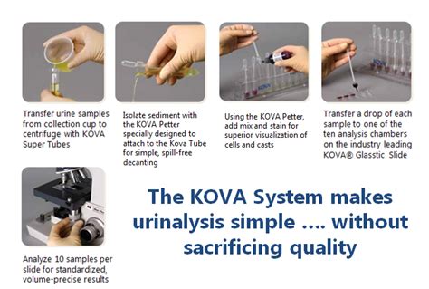 A Complete Urinalysis System