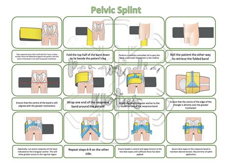 Pelvic Splint/binder - Etsy UK