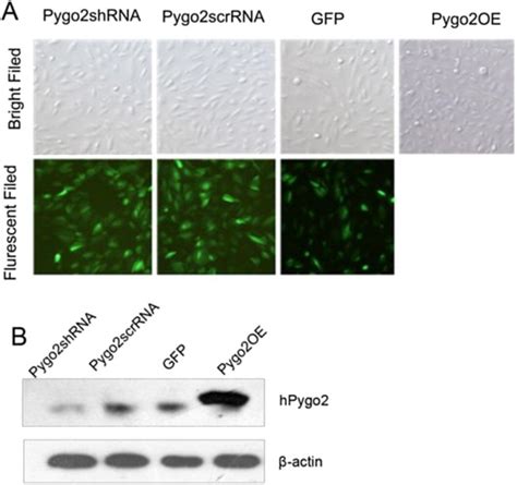 Knockdown And Overexpression Of Pygo2 By Pygo2 Shrna And An