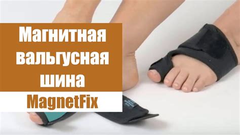 🤒 НАСАДКА НА БОЛЬШОЙ ПАЛЕЦ НОГИ 💣 ФИКСАТОР ВАЛЬГУС - YouTube