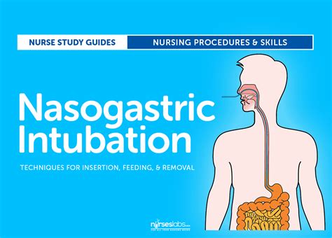 Nasogastric Intubation Insertion Procedures And Technique