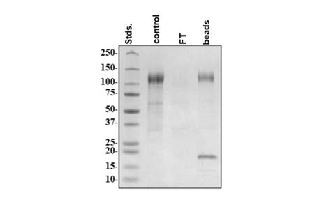 Spike S P Variant Avi His Tag Biotin Labeled Sars Cov