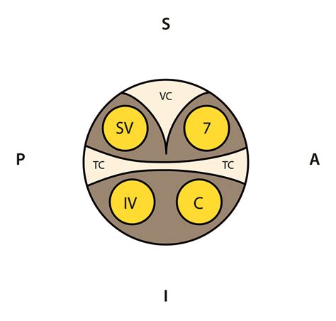 Internal Auditory Canal and Cerebellopontine Angle – Oto Surgery Atlas