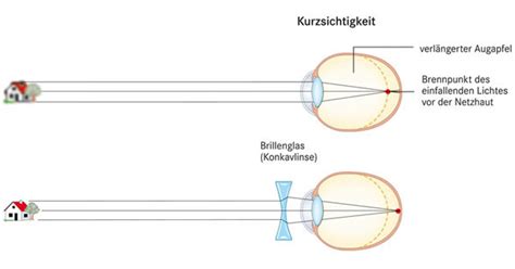 Optische On Emaze