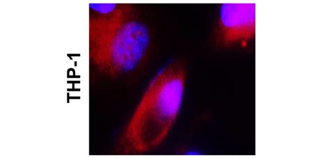 Inflammation Antibody Panel Irap Ireal Biotechnology Inc