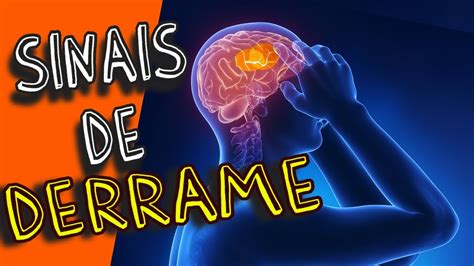 DERRAME CEREBRAL SINAIS E SINTOMAS De Um AVC 2022 YouTube